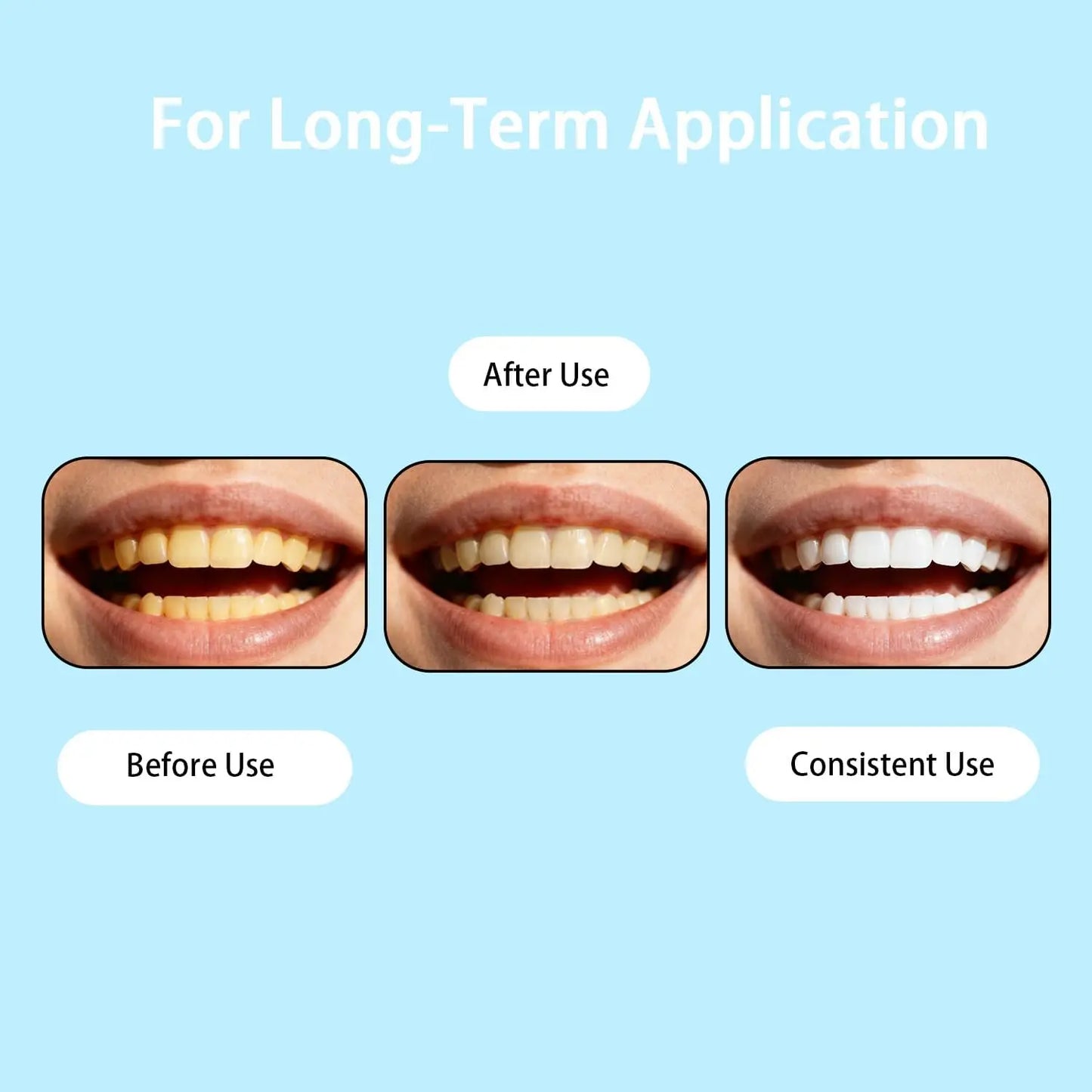 Damaged Gum Repair Care Gel Serum - Soothe Sore Gums Deep Clean Teeth Remove Plaque & Tartar for Teeth Whitening & Dental Care